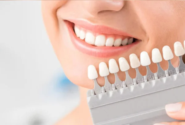 Teeth Whitening